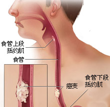 科學(xué)防治  、與“食”俱進(jìn)