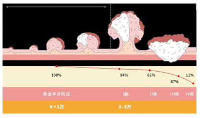 科學(xué)防治消化道早癌