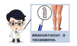 預(yù)防下肢靜脈疾 呵護(hù)人生健康路