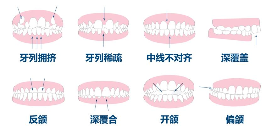 開掛人生，竟始于這個不起眼的改變